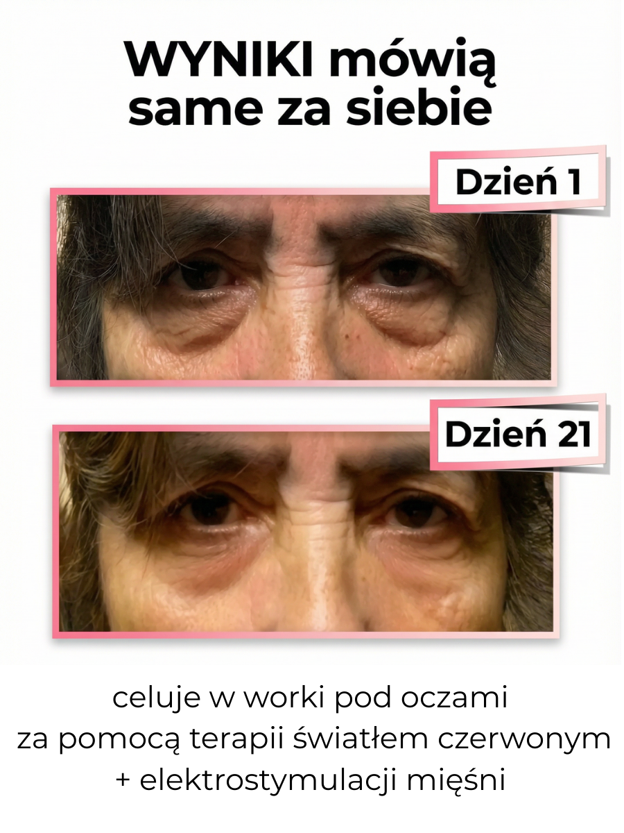 Masażer okolic oczu LumiEyes™