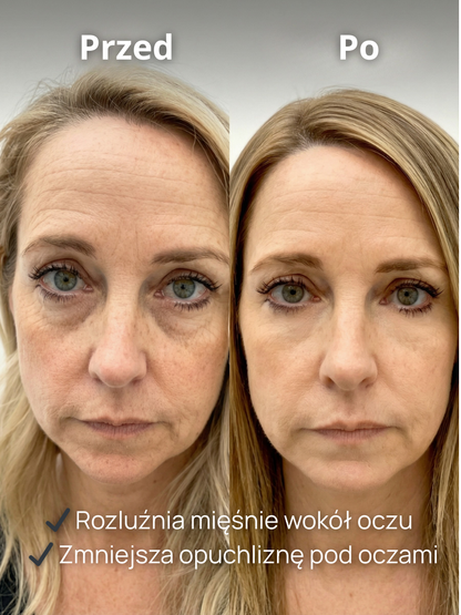 Masażer okolic oczu LumiEyes™