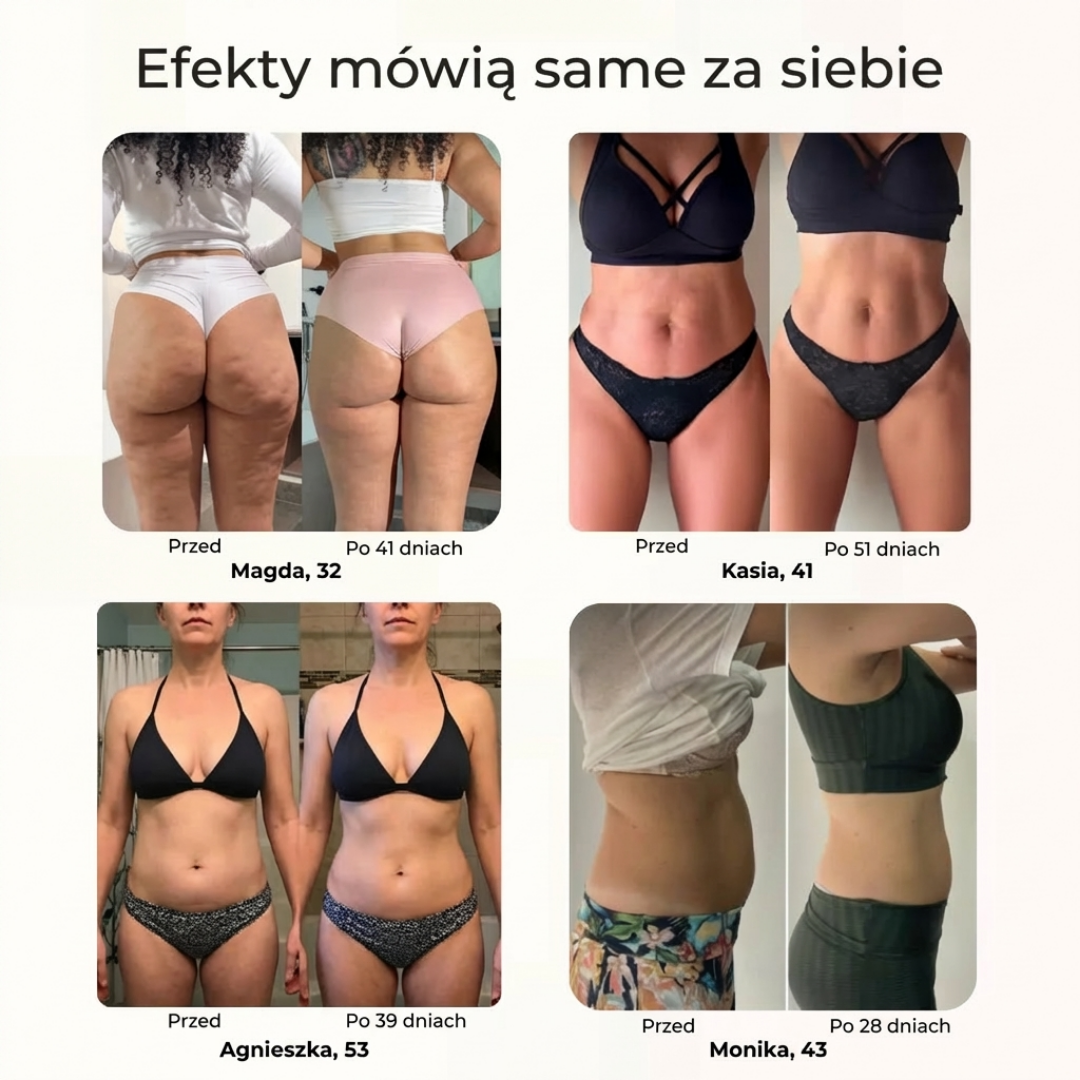 Elektryczny masażer rolkowy SculptRoll™