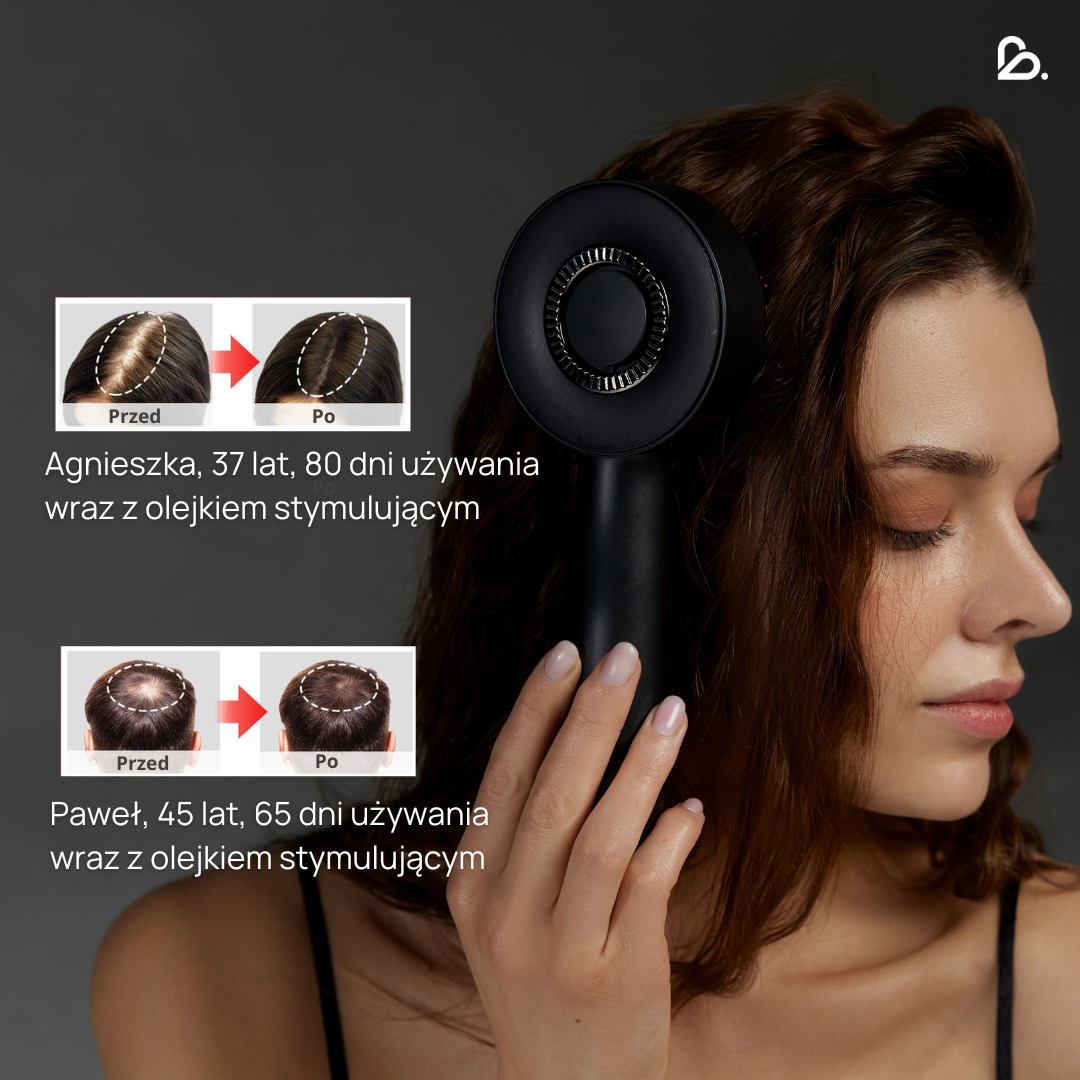 Masážní přístroj na pokožku hlavy VitalScalp™