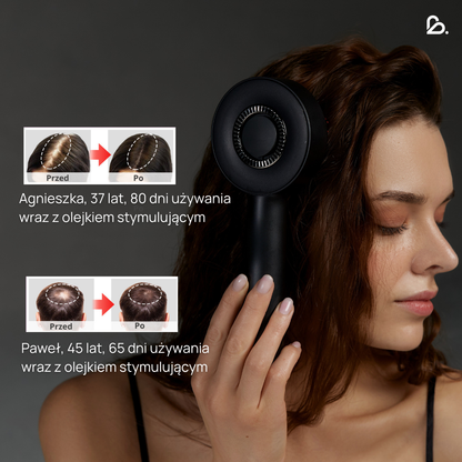 Masážní přístroj na pokožku hlavy VitalScalp™